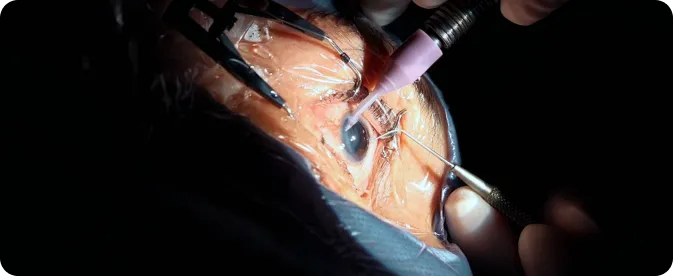 SEGMENTO ANTERIOR